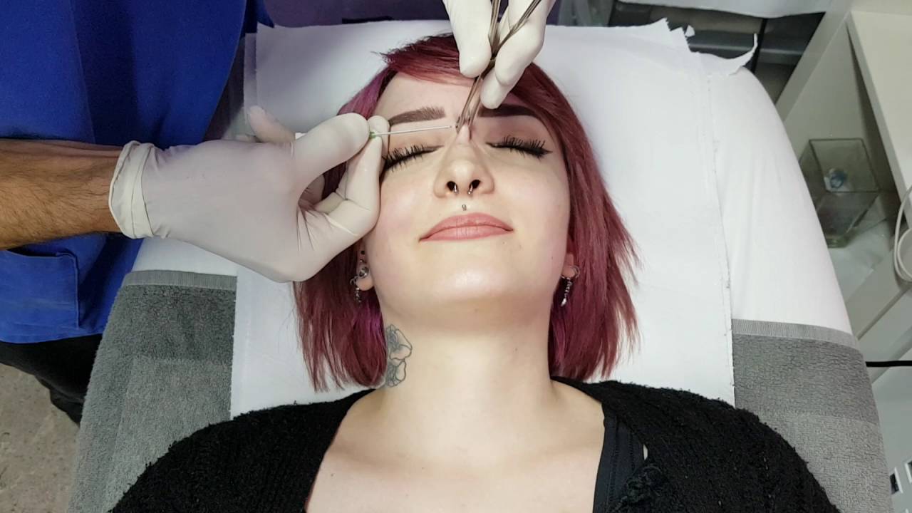 nose bridge piercing procedure