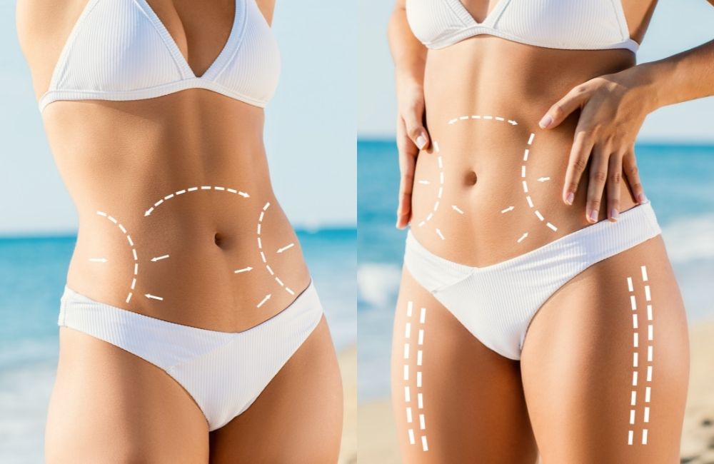 body contouring treatment