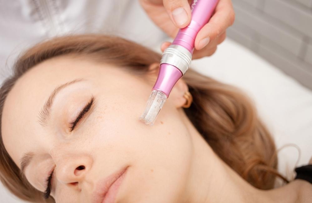 How Much Does Microneedling Cost